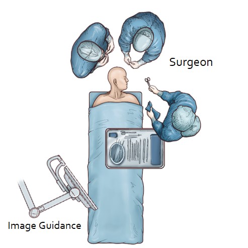 Right Pterional Approach for Clipping of Anterior Communicating Artery ...